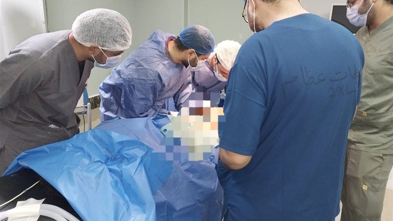 إحدى عمليات الجراحة