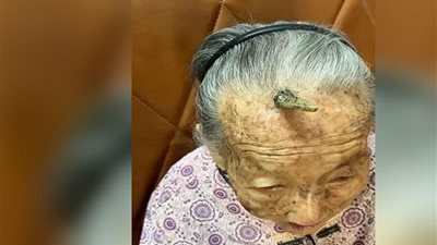 قرن طول العمر ينمو على جبهة عجوز صينية، ما القصة؟