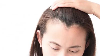 وصفة طبيعية لتقوية الشعر من الجذور ومنع تساقطه 