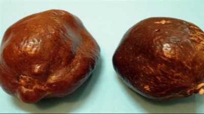 الدوم يعزز صحة الكبد وينظم مستوى السكر بالدم ويقوي المناعة 