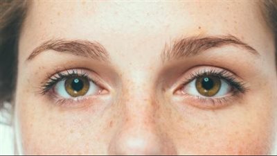 قناع طبيعي يقلل ظهور النمش بالبشرة ويعيد نضارتها 