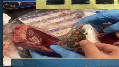 ضبط راكبة حاولت تهريب حشيش داخل لحوم مجمدة بمطار القاهرة 