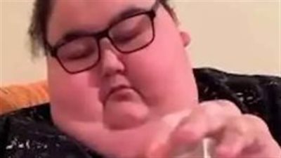 ضحايا محبي الأكل ، نقل تركي مشهور يعاني من السمنة المفرطة للمستشفي 