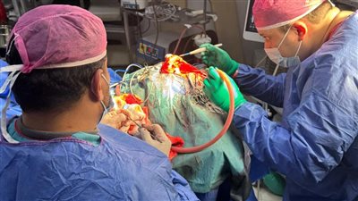صحة المنوفية: نجاح عملية جراحية معقدة لإنقاذ حياة مريض في مستشفى الجراحات المتخصصة (صور)
