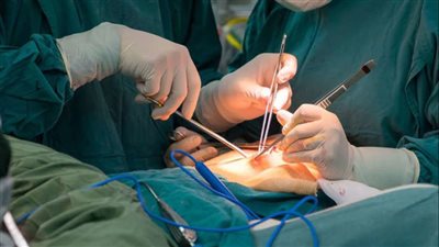 التزامات الأطباء قبل إجراء العمليات الجراحية، تعرف عليها