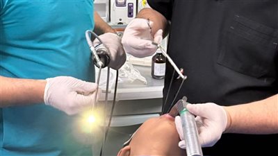 استخراج لمبة ريموت من القصبة الهوائية لطفل في مستشفى بنها التخصصي للأطفال