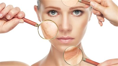 أفضل الوصفات الطبيعية للعناية بالبشرة الجافة في الشتاء