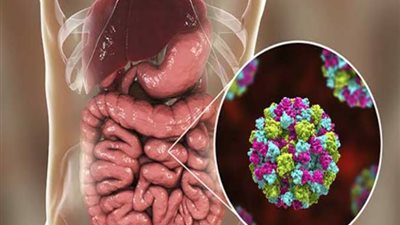 بعد انتشاره بأمريكا، مخاوف من تزايد إصابات نوروفيروس وهذه أعراضه 