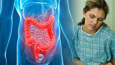 أسباب التهاب القولون المختلفة، وطرق علاجه والوقاية منه