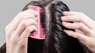 ما هي أسباب قشرة الشعر؟ وكيف يُمكنك التخلص منها نهائيا؟
