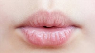 مع دخول الشتاء.. تخلصي من تشقق الشفاه سريعًا