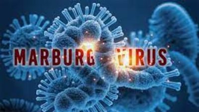 4 أسباب تؤكد استحالة انتقال فيروس ماربورج إلى مصر