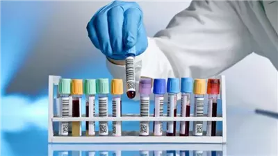 كوارث معامل التحاليل.. نتائج خاطئة تقلب حياة المواطنين.. والإهمال يهدد صحة المرضى.. الضحايا يكشفون رحلة التشخيص الخاطئ وكيفية اكتشافه