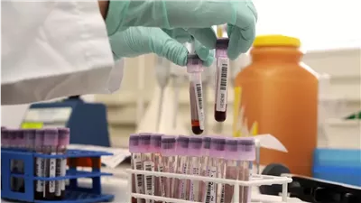 حقيقة توقف تحليل المنشطات في مباريات الدوري 