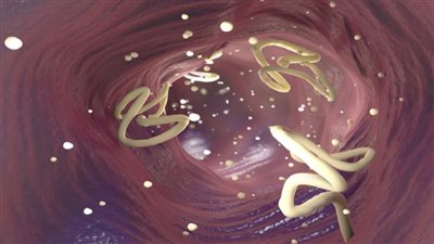 كائنات خطرة تغزو جسد رجل وتصيب طبيبه بالذهول (فيديو)