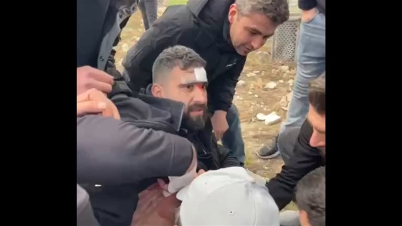 إصابات في فريق روسيا
