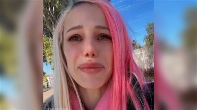 إصابة مغنية أمريكية بمرض ترقق العظام بعد حقنة لإنقاص الوزن