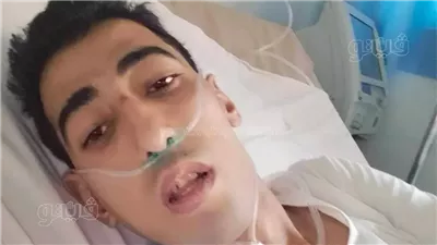 شاب شرقاوي يعيش على أجهزة التنفس منذ 5 سنوات ويحتاج لزراعة رئتين بـ 15 مليون جنيه (صور) 