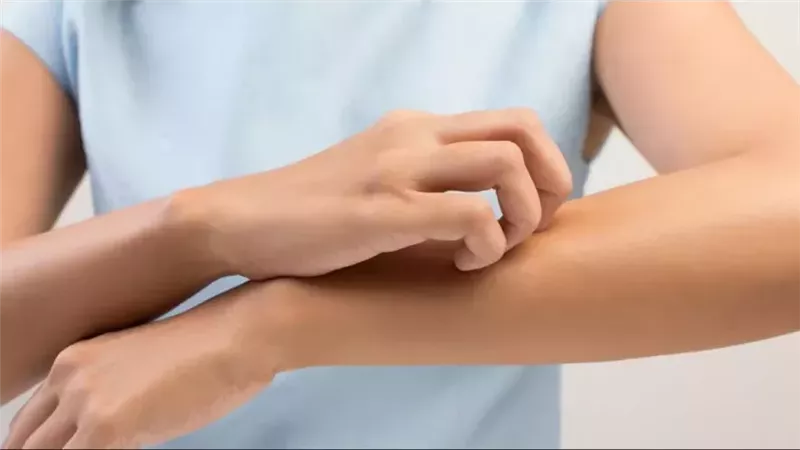 اسباب حكة الجلد،