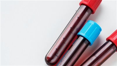 أبرزها البول واللعاب، ما هي الاختبارات المستخدمة للكشف عن تعاطي المخدرات؟