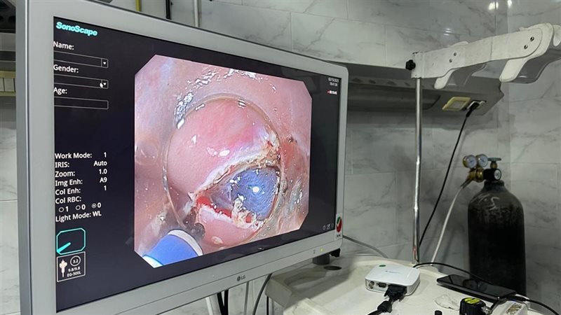 إجراء تدخلات متطورة