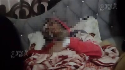 ضبط المتهم بضرب زوجته وإصابتها بـ 30 غرزة في الغربية 