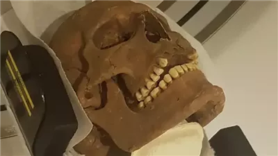 تحليل جماجم الفايكنج يكشف عن إصابتهم بالعديد من الأمراض 