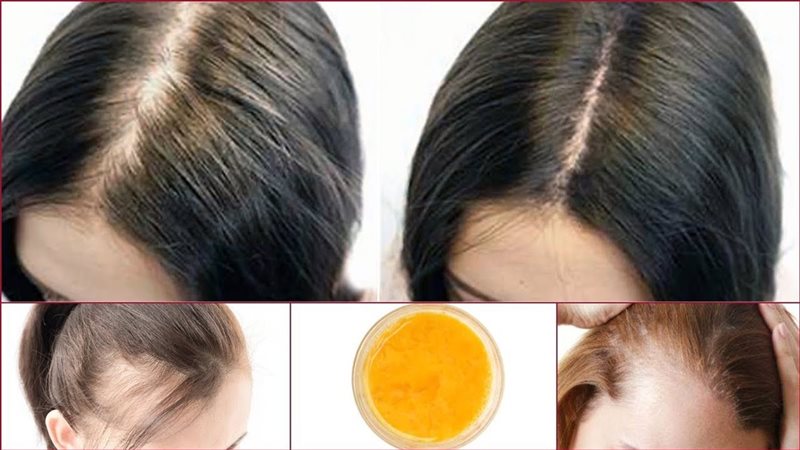 الشعر الخفيف وعلاجه
