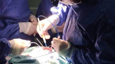 نجاح جراحة معقدة لإنقاذ طفل اخترق رأسه سيخ معدني (صور) 