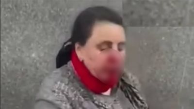 بسبب تذكرة الدخول، القصة الكاملة لاعتداء فرد أمن على سيدة بمستشفى الأزهر في دمياط (فيديو وصور)