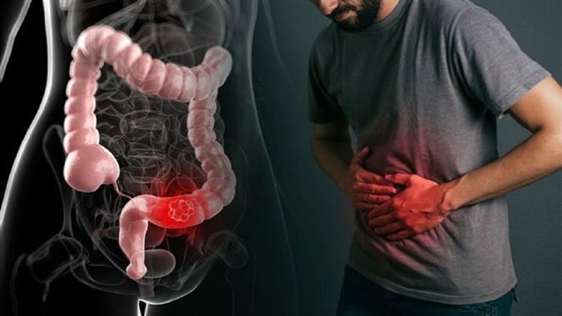 علاج الإمساك، فيتو