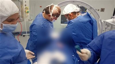  فريق جراحة المخ والأعصاب بمستشفى قها ينقذ شابا تعرض لحادث من شلل كلي 