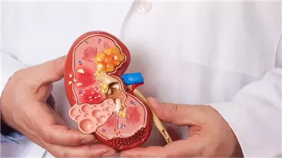 درع الجسم الصامت، نصائح للحفاظ على صحة الكلى