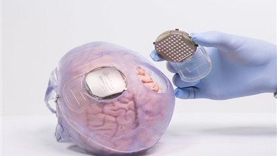 التخطيط لزرع شرائح تحفيز في أدمغة مدمني الكحول والمخدرات في بريطانيا