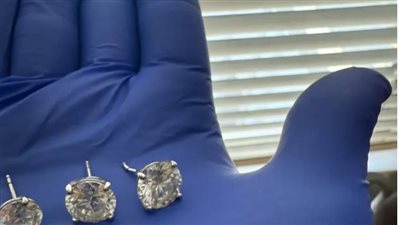 شرطة فلوريدا تستعيد أقراط ماسية ابتلعها لص 