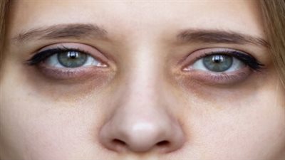 قناع طبيعي يقضي على الهالات السوداء قبل العيد 