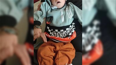 وحدة أمراض الدم للأطفال بمستشفى سوهاج تبدأ العلاج الإنزيمي لحالات نيمان-بيك