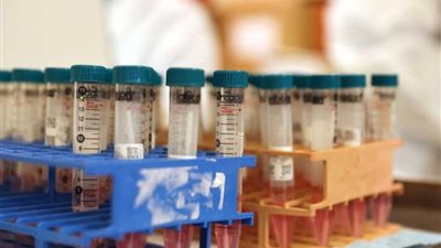 أوميكرون السبب.. التفاصيل الكاملة وراء تعاون فلسطين واسرائيل سويًا 