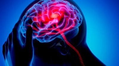 أعراض جلطة المخ وأهم المضاعفات 