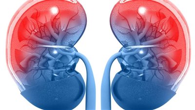 الصحة العالمية: 11% من السكان لديهم خلل في وظائف الكلى تتطور لفشل كلوي 