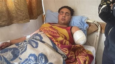 بعد حادث عامل سيرك طنطا، ما مقدار دية قطع اليدين وحكم التصالح فيها؟ 