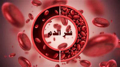 بعد إصابة 40% من المصريين، خطورة فقر الدم وأهم أسبابه