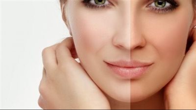 قناع البطاطس لتوحيد لون البشرة وتعزيز نضارتها 