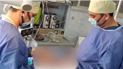 فريق طبي بالإسكندرية يُنقذ مريضًا من خراج رئوي ضخم