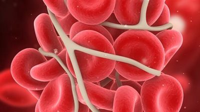 ما لا تعرفه عن سرطان الدم، هيئة الدواء توضح الأنواع والمضاعفات