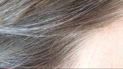 وصفة طبيعية للتخلص من الشعر الأبيض سريعا 