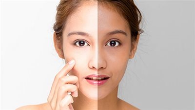 وصفة طبيعية تخلصك من البقع بالبشرة وتوحد لونها