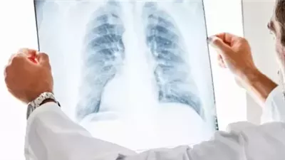 المياه على الرئة، حالة طارئة تهدد الحياة وتستدعي التدخل الفوري