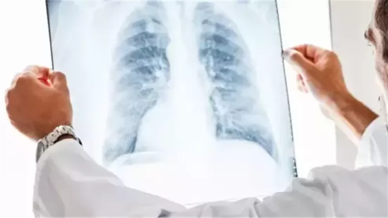 المياه على الرئة،