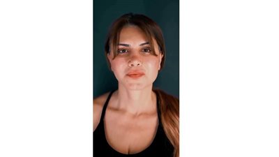 أول رد من الفنانة نجلاء بدر بعد إجراء عملية تجميل وتغير ملامح وجهها ( صور)